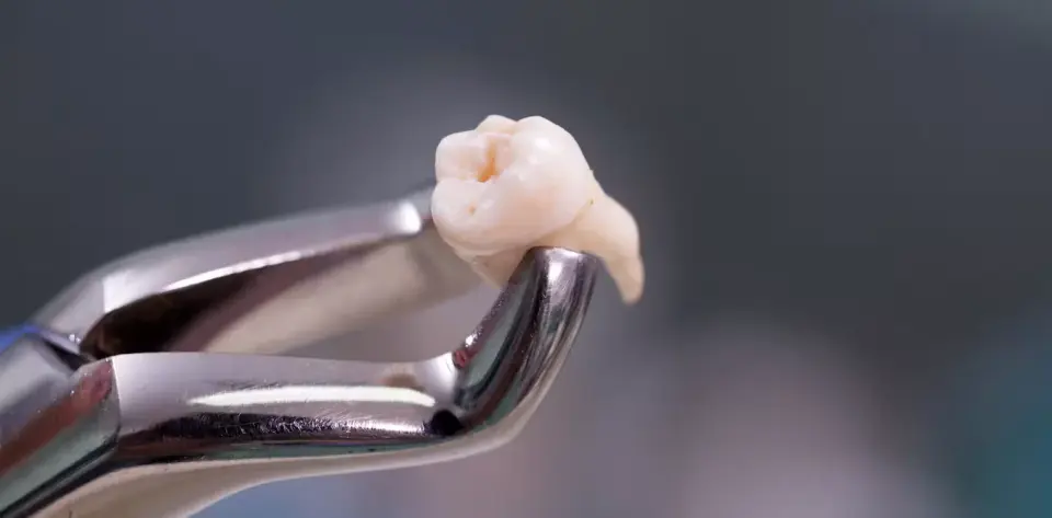 First documented case of a tooth erupting in an eye socket highlights rare developmental anomaly