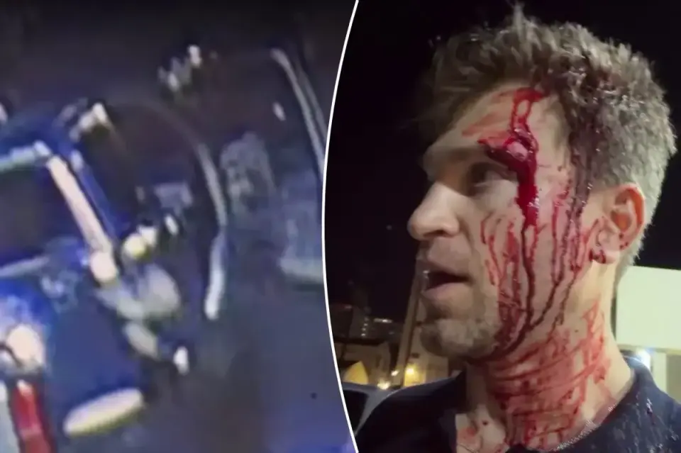 Actor Keegan Allen Injured in Armed Robbery Outside West Hollywood Grocery