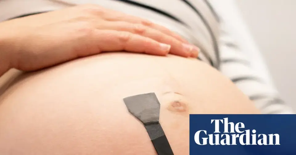 Wearable ultrasound patch promises continuous fetal monitoring