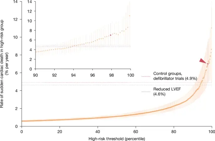 AI-detected ECG signature reveals new high-risk group for sudden cardiac death