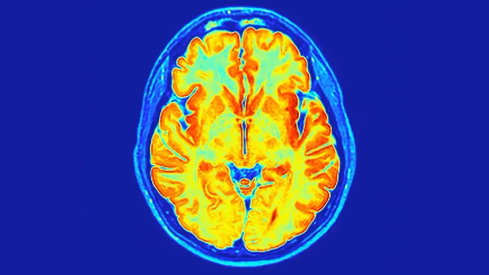 New ReNU2 Syndrome Emerges: A Non-Coding RNA Defect Driving Neurodevelopmental Disorder