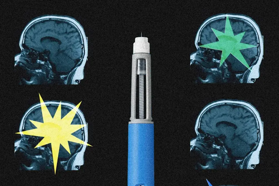 Ozempic May Rewire the Brain, Changing Mood, Motivation and Cravings