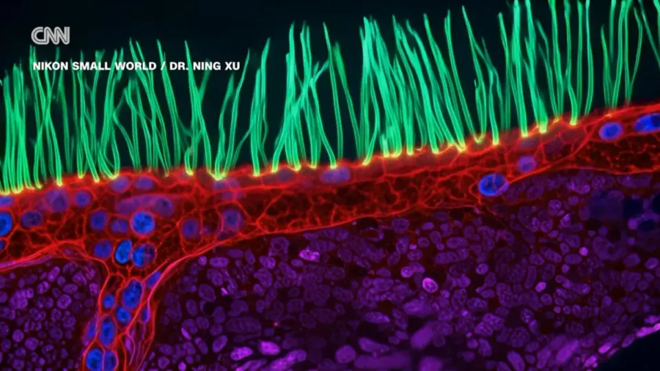 Nikon Re-Evaluates Microscopy Prize After AI Watermark and Biological Errors Surface