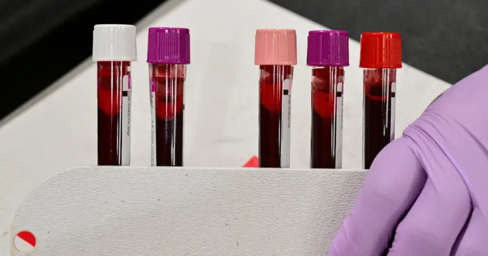 New Hematology Guidelines Lower Thresholds to Catch Undiagnosed Iron Deficiency