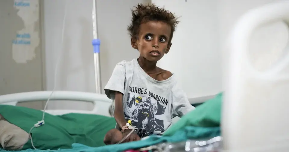Yemen’s Health System Collapses as Houthi Advance Triggers Mass Displacement and Malnutrition