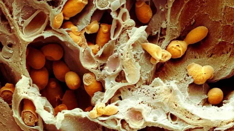 Gladiolin: Bacterial Antibiotic Shows Promise Against Drug-Resistant Fungal Infections