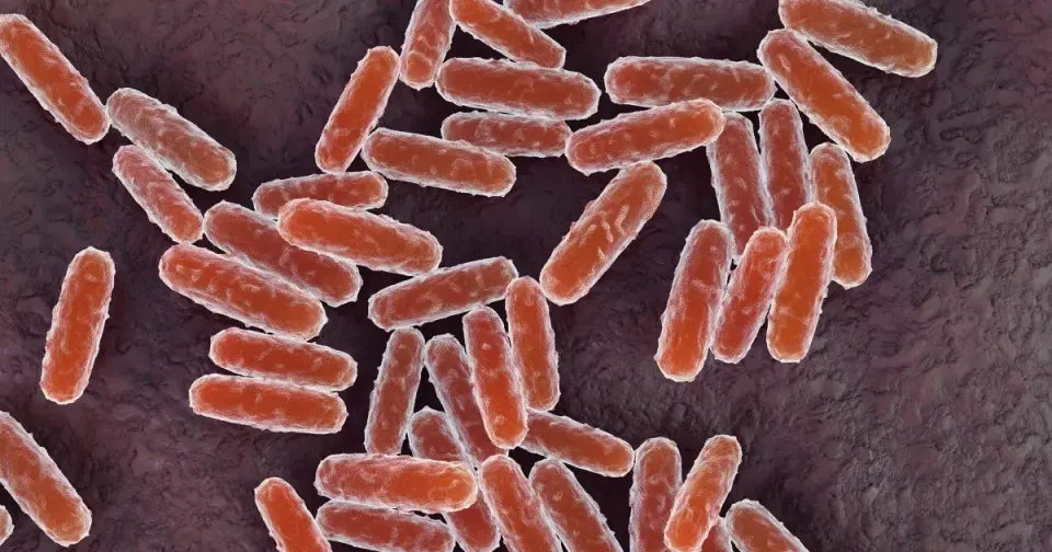 Russia Denies Plague Lab Accident as US Monitors Siberian Death