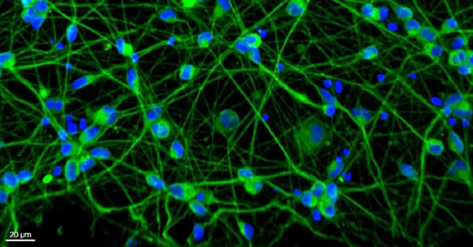 Scientists Aim to Clean Up RNA Pollution to Halt Neurodegeneration