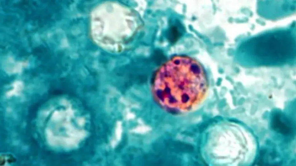 North Carolina reports 906 cyclosporiasis cases as Wake County leads