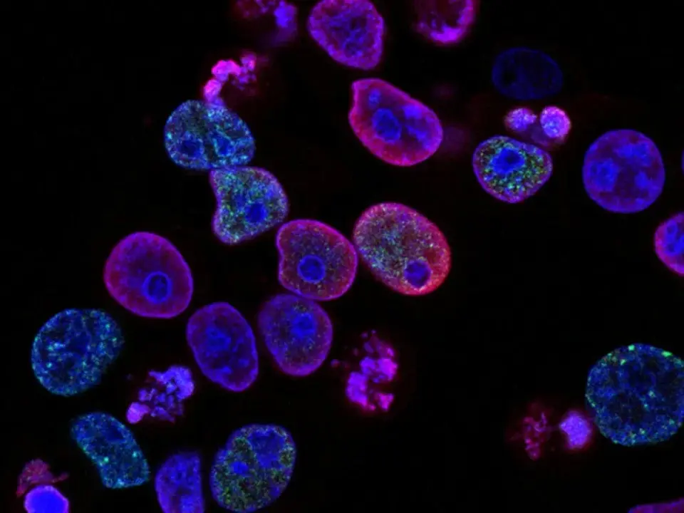 First Human Trial Tests Rejuvenation of Aging Eye Cells for Glaucoma