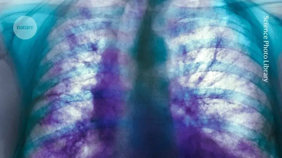 Mice reveal a genetic gateway that could slow a deadly lung disease